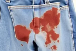 tirar manchas de jeans sem desbotar